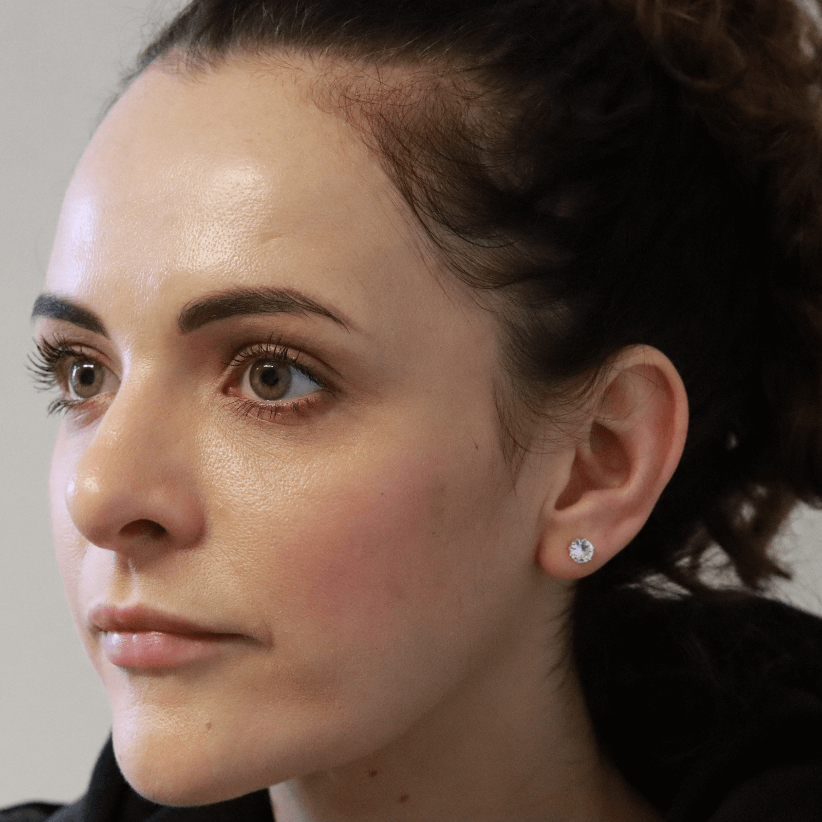 Dermal Filler Belfast Facial Structural Restoration | £300 per ml | Array
