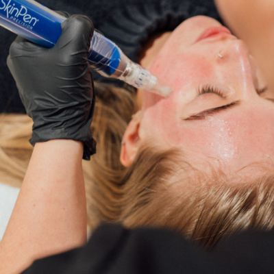 Treatment sample